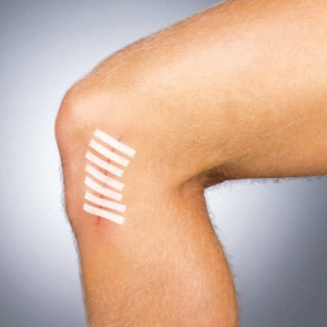 Suture Strip® Plus Tiras Flexibles de Cierre de Heridas - Estéril